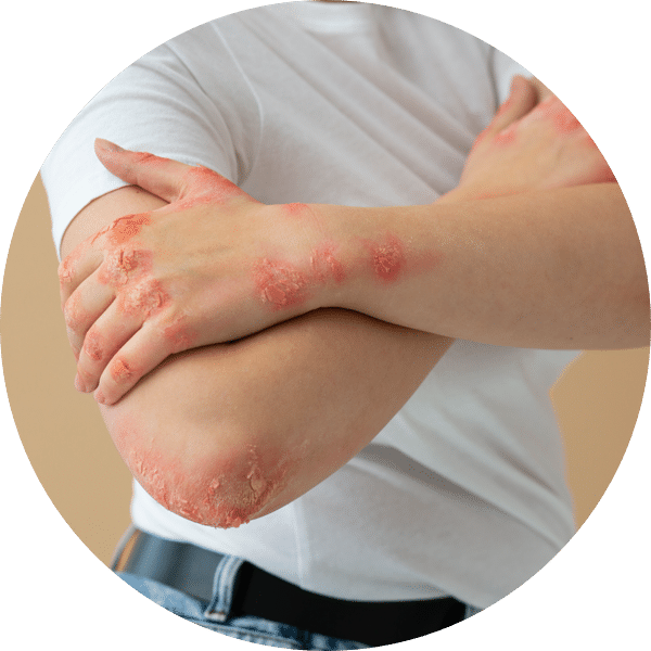 Abnormal ulcers, lumps or bumps over genital, rectal or oral region