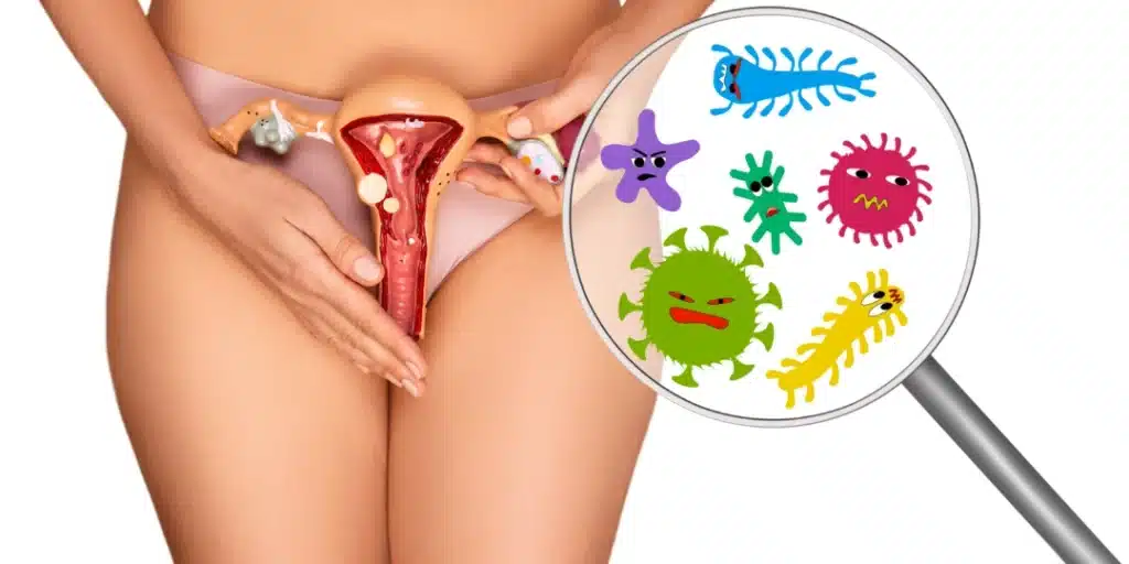 Infection female reproductive system