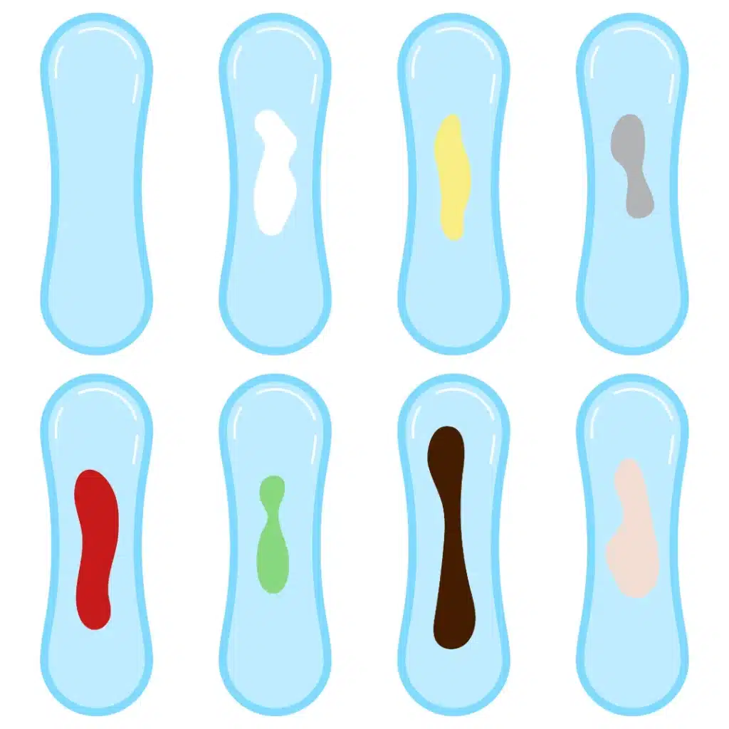 Vaginal discharge