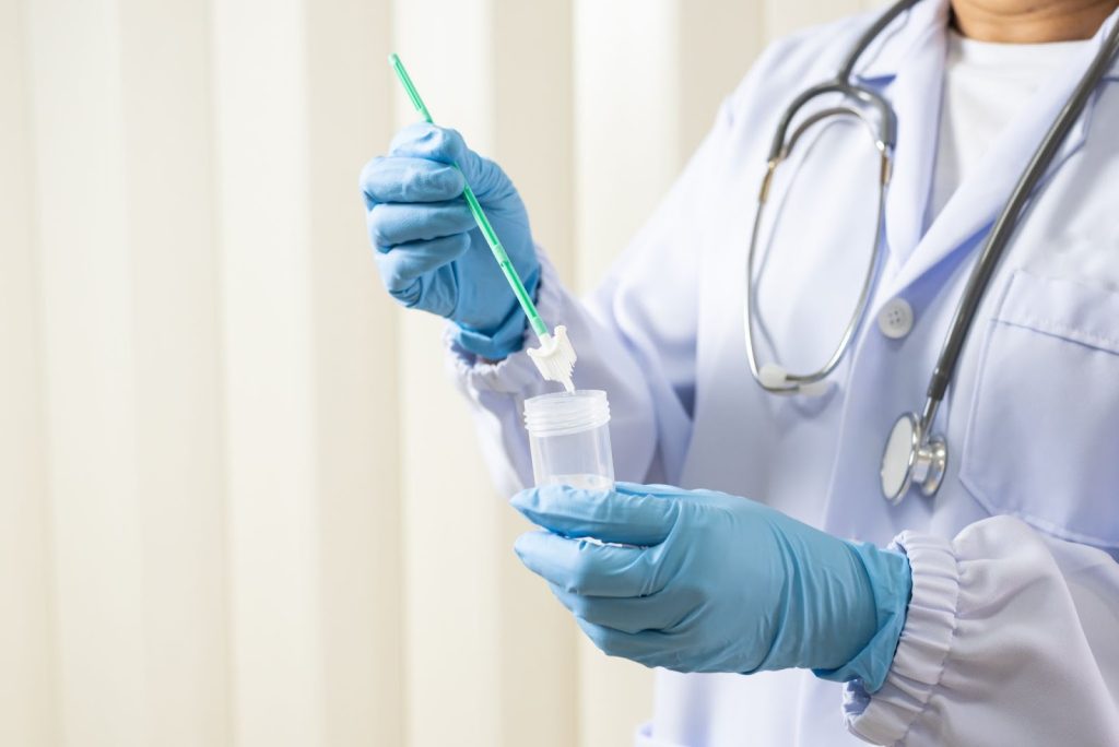 HPV test smear